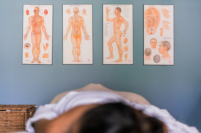 What Exactly Is Acupuncture?